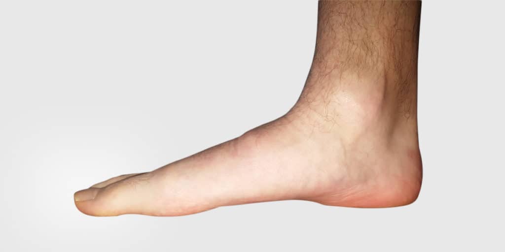 Orthotics – Healthcare or Business - Orthotics – Healthcare or Business? - Gemini Health Group - Richmond Hill Physiotherapy & Wellness - Most Trusted And Respected Provider Of Physiotherapy And Wellness Services In York Region